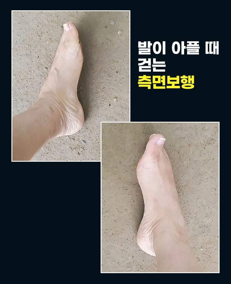 발이 아플 때는 발 바깥쪽으로 걷는 '측면 보행'으로 시작합니다